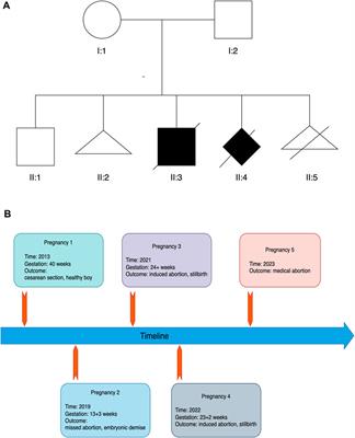 CEP55-associated lethal fetal syndrome: a case report of a Chinese family